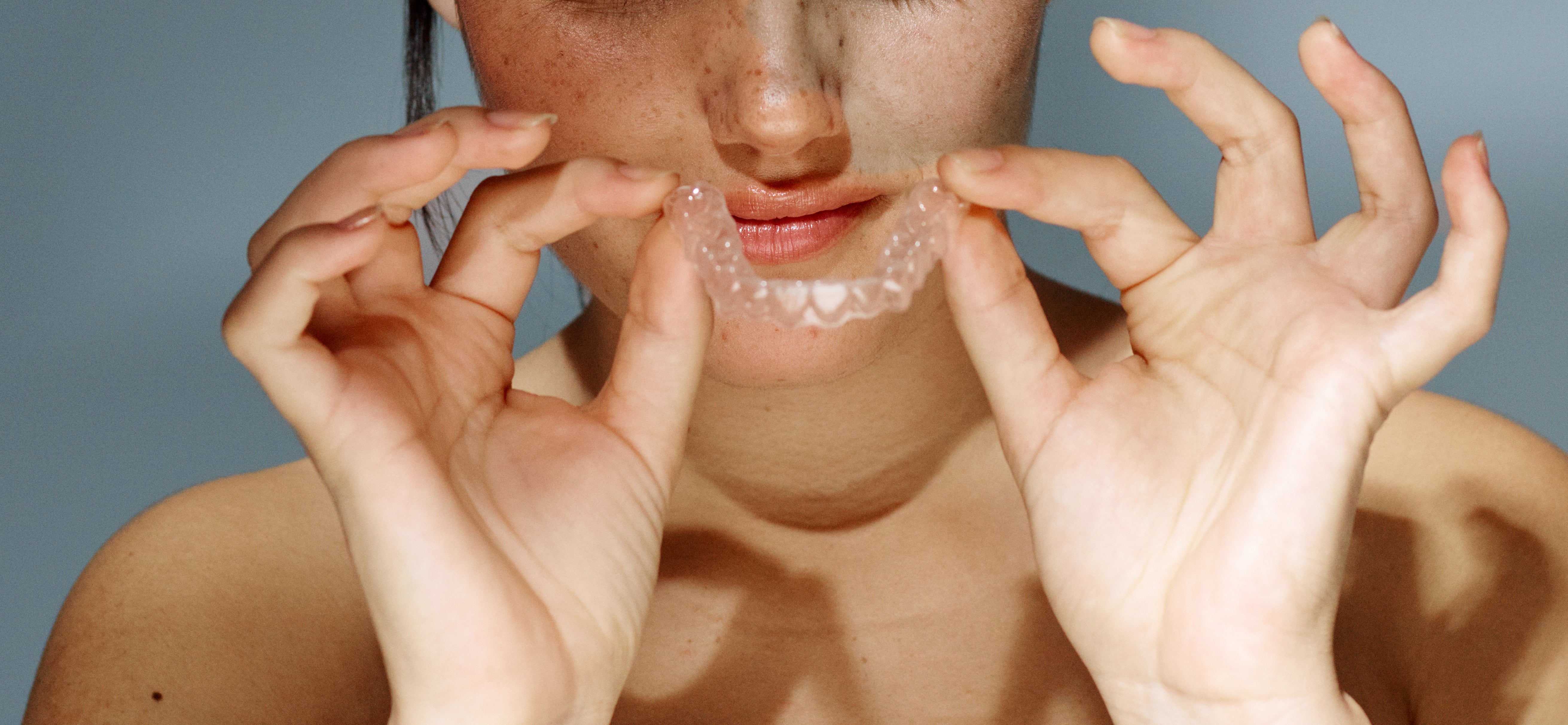 GleamFit Aligners vs Aligner Co: Which One is Right for You?