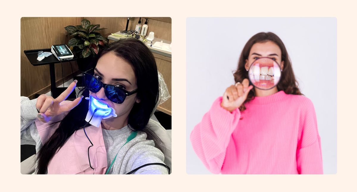 Teeth Whitening at Home vs. Teeth Whitening at The Gleamery Which Is