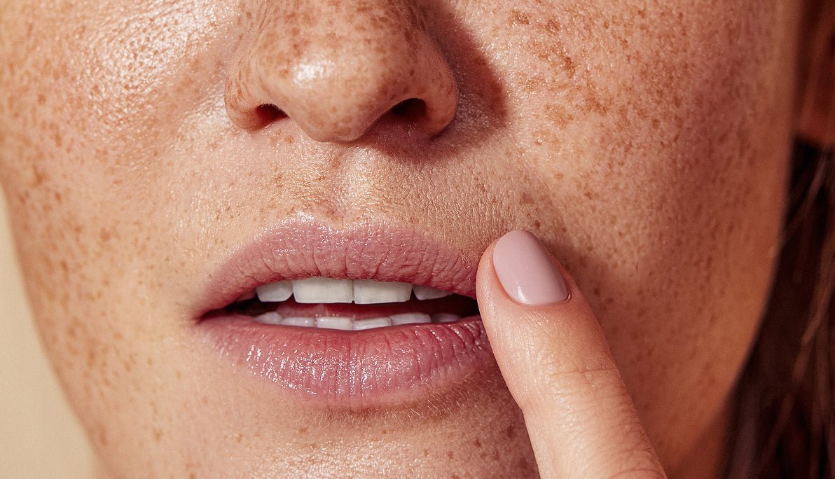 Are Veneers Hiding Problems? What You Should Know Before You Get Veneers