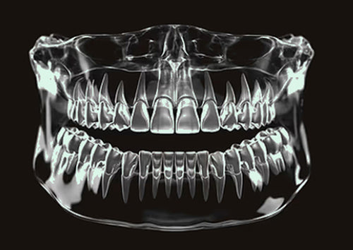 X-ray